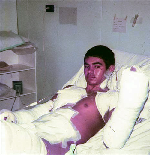 Andy Mokaraka at the 1st Australian Field Hospital, circa 1971 Andy Mokaraka at the 1st Australian Field Hospital, circa 1971